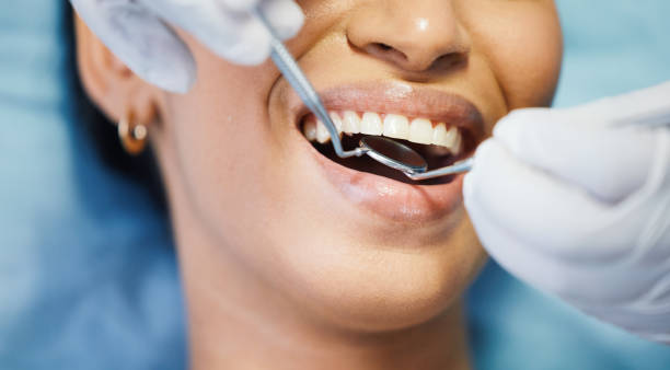 Best Chipped Tooth Repair Near Me  in Jenkintown, PA